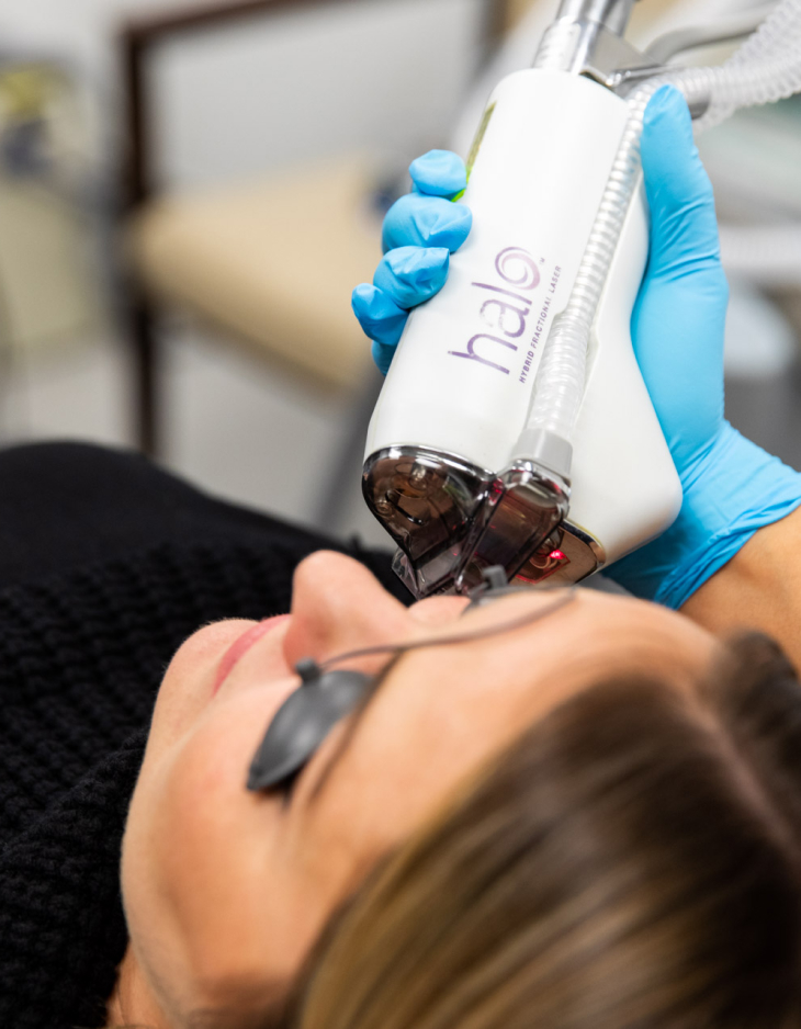 Halo laser treatment being performed on a patient